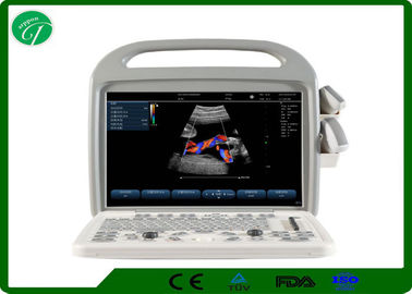 China Automatic Fetal Color Doppler Ultrasound , Digital Ultrasound Scanner Winder Angle supplier