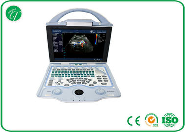 China Full Digital Doppler Ultrasound Machine Multi - Frequency Probe With A8 Embedded System supplier