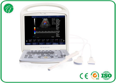 High Performance Color Doppler Ultrasound Scanner CFM / PDI / PW 64G Capacity supplier