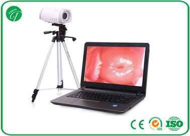 Portable Health Medical Equipment , Digital Electronic Colposcope Equipment supplier