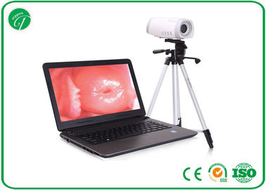 Portable Health Medical Equipment , Digital Electronic Colposcope Equipment supplier
