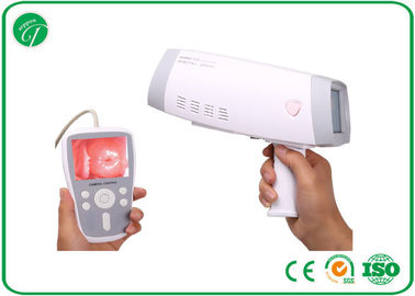 Colposcope Hospital Medical Equipment For Gynecology Ring Fiber Lens supplier