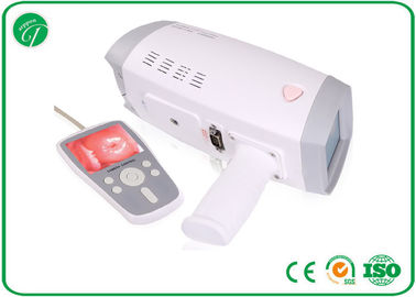 Colposcope Hospital Medical Equipment For Gynecology Ring Fiber Lens supplier