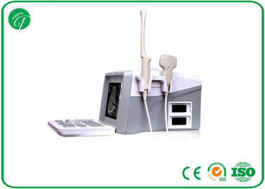 8 Segment TGC Real - Time B Mode Ultrasound Scanner OB Measurement ​Stable Screen supplier