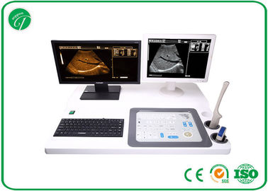 Intelligent Type B Ultrasound Machine For Pregnancy With Double Screens supplier