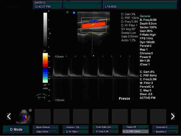 Two USB Ports Color Doppler Ultrasound Scanner Cavity Probe High Performance Image supplier