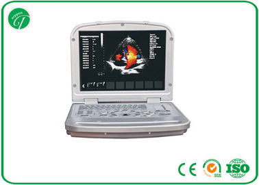8 Segment TGC Color Doppler Ultrasound Scanner 15'' LCD Monitor 64G Capacity supplier