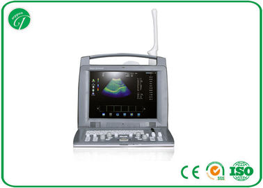 8 Frame - Related 12'' Portable 3D Color Doppler Ultrasound For Hospital / Clinic supplier