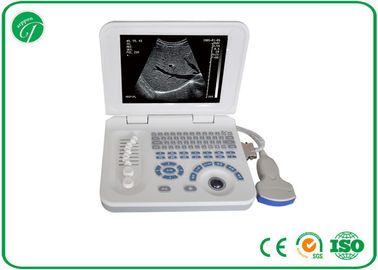 Full Digital B Mode Ultrasonography , Palm Ultrasound Scanner Video Recorder supplier