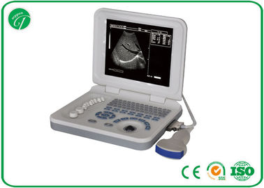 Full Digital B Mode Ultrasonography , Palm Ultrasound Scanner Video Recorder supplier