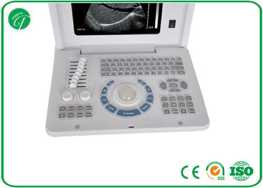 Full Digital B Mode Ultrasonography , Palm Ultrasound Scanner Video Recorder supplier