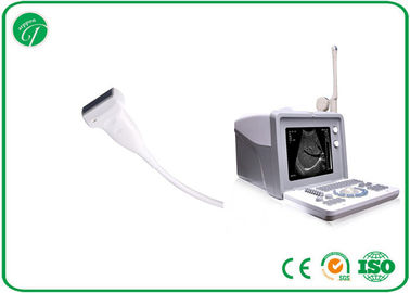 Hospital Professional Portable B Mode Ultrasound Scanner 3.5Mhz Convex Probe supplier