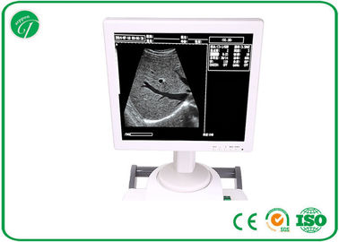 14 Inch Examining Liver B Mode Ultrasonography 186 / 236 Frames For Hospitals / Clinics supplier