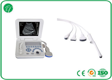 Smart Digital B Ultrasound Scanner CRT Stable Screen All Kinds Of Measurements supplier