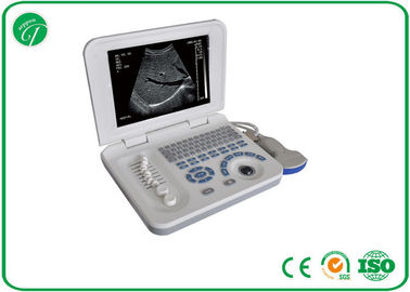 Full Digital Hospital Medical Equipment For B Mode Laptop Ultrasound Scanner CE supplier