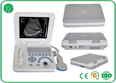 Human B Mode ultrasonic scanning , Laptop pregnancy Ultrasound Scanner Handheld supplier
