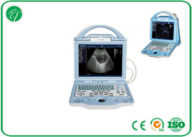 Fully Digital type b Laptop Ultrasound Scanner with duable power supply mode supplier