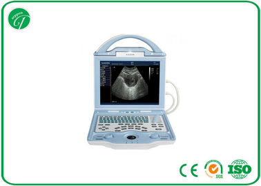 Fully Digital type b Laptop Ultrasound Scanner with duable power supply mode supplier