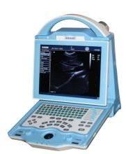 Fully Digital type b Laptop Ultrasound Scanner with duable power supply mode supplier