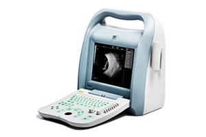 Portable Digital Ultrasound Scanner , Fetal Color Doppler Ultrasound In Pregnancy supplier