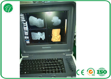 12'' 3D / 4D Color Doppler Ultrasound Scanner With Electronic Linear / Convex 2 Probe supplier