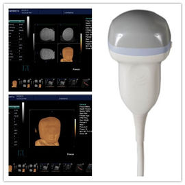 Portable B Mode Ultrasound Scanner With Windows System Ultrasound Imaging Equipment supplier