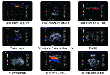 Handheld 4D Color Doppler Ultrasound Scanner With ITouch 2 USB Ports supplier