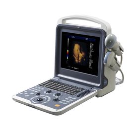 Handheld 4D Color Doppler Ultrasound Scanner With ITouch 2 USB Ports supplier