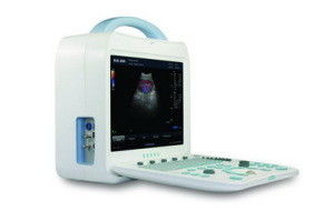 Surgery Hospital Medical Equipment Full Digital Color Doppler Ultrasound Scanner supplier