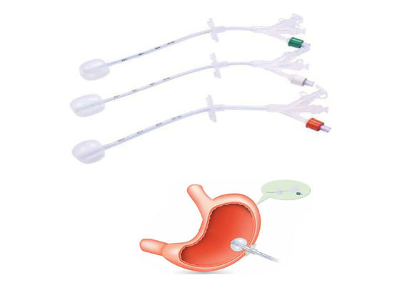 Silicone Gastrostomy Feeding Tubes endoscopic surgery gastrostomy tube supplier